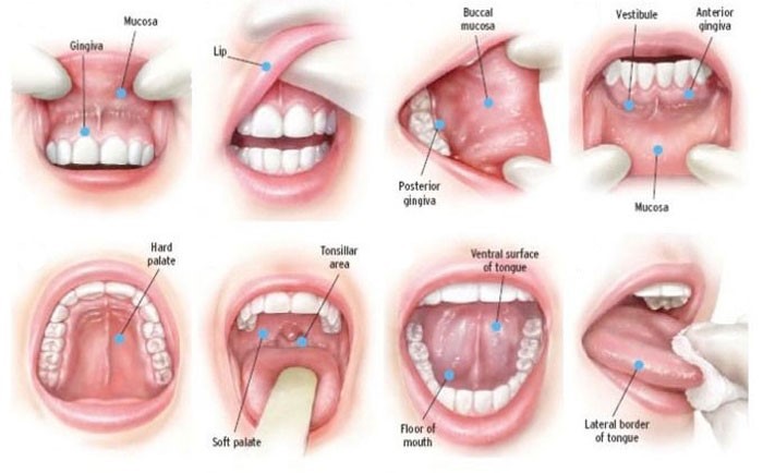 mouth sores